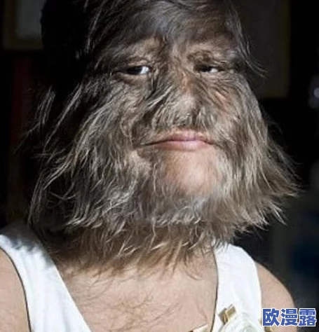 欧美老妇多毛：探讨文化背景、遗传因素及美容观念对多毛现象的影响和社会认知变化