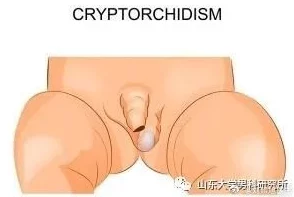 不小心看到了男生的睾丸怎么办?心理健康与性教育的重要性及应对策略分析 不小心看到了男生的睾丸怎么办?心理健康与性教育的重要性及应对策略分析