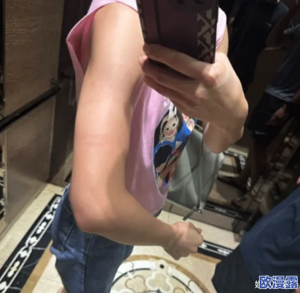 巴掌狠揍红肿臂瓣，内幕曝光：涉及明星绯闻和办公室恋情