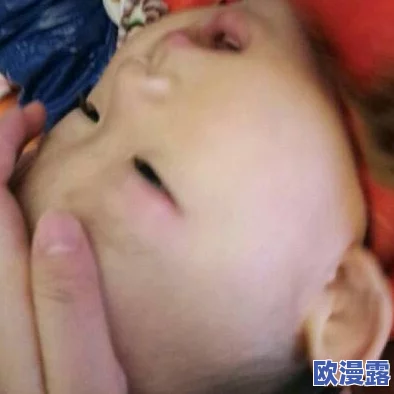 表妹红肿疼痛小缝不能合拢小孩，医生建议及时就医以防感染并进行必要的后续治疗